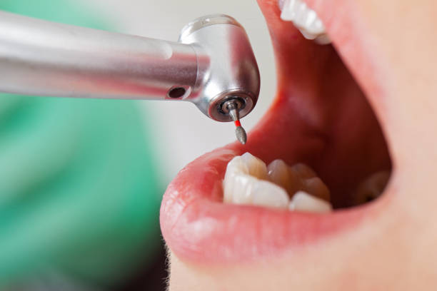 Best Cosmetic Emergency Dentistry in Mount Sterling, KY